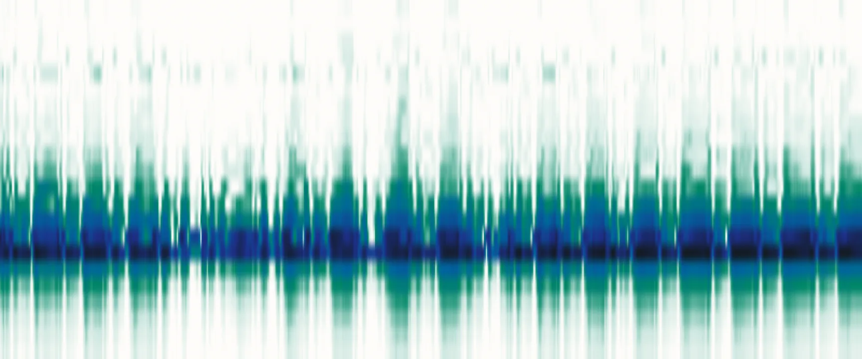 Radar range over time: one bright band that pulses with each breath